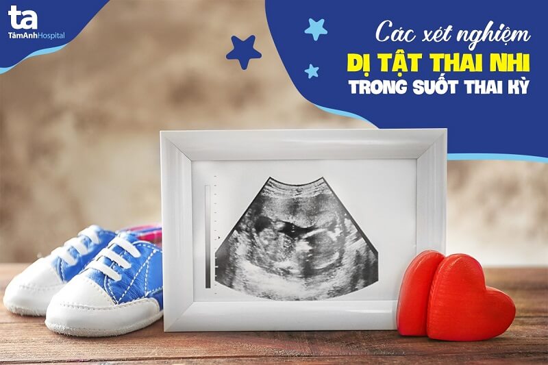 Từ a mang đến z những xét nghiệm dị dạng thai nhi trong veo thai kỳ Từ a cho z những xét nghiệm biến dạng thai nhi nhìn trong suốt thai kỳ