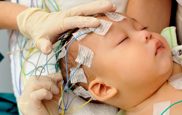 Động tởm và tác động của hễ kinh cho cơ thể Động ghê và ảnh hưởng của đụng kinh mang lại cơ thể