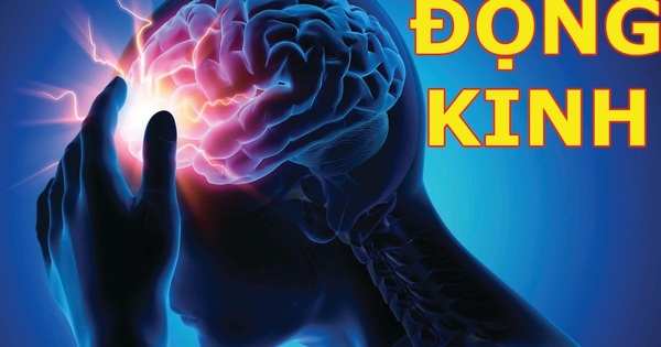 Bệnh động kinh cách nhận biết xử trí và phần nhiều điều buộc phải tránh Bệnh cồn kinh cách nhận ra xử trí và hầu hết điều bắt buộc tránh