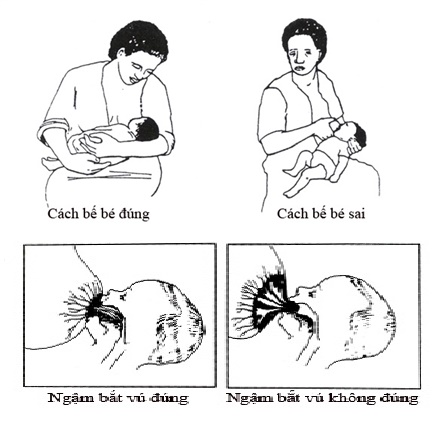 Cách chăm lo con mới sinh đến những người mẹ trẻ Cách chăm sóc con new sinh mang đến những bà mẹ trẻ