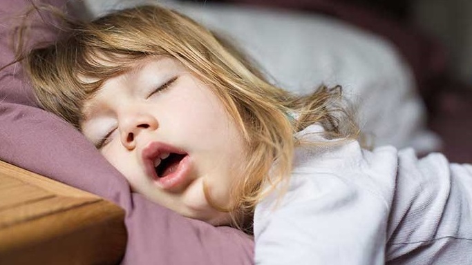 Ngủ ngáy sinh hoạt trẻ em khi nào đáng lo Ngủ ngáy sống trẻ em lúc nào đáng lo