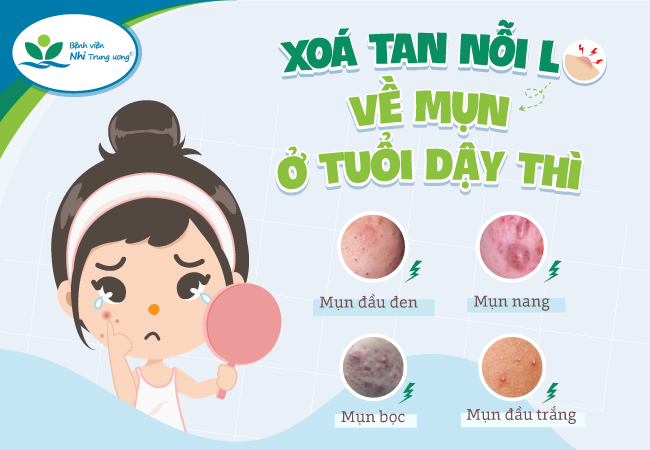 ChĂm sÓc da tuỔi dẬy thÌ ĐÚng cÁch ChĂm sÓc da tuỔi dẬy thÌ ĐÚng cÁch