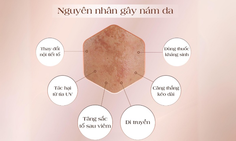Kinh nghiệm trị nám ở khám đa khoa da liễu có tốt không Kinh nghiệm trị nám ở bệnh viện da liễu có xuất sắc không