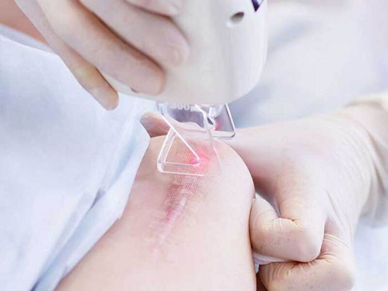 Chi chi phí là sẹo lồi ngơi nghỉ viện bao nhiêu Chi chi phí là sẹo lồi ở viện bao nhiêu