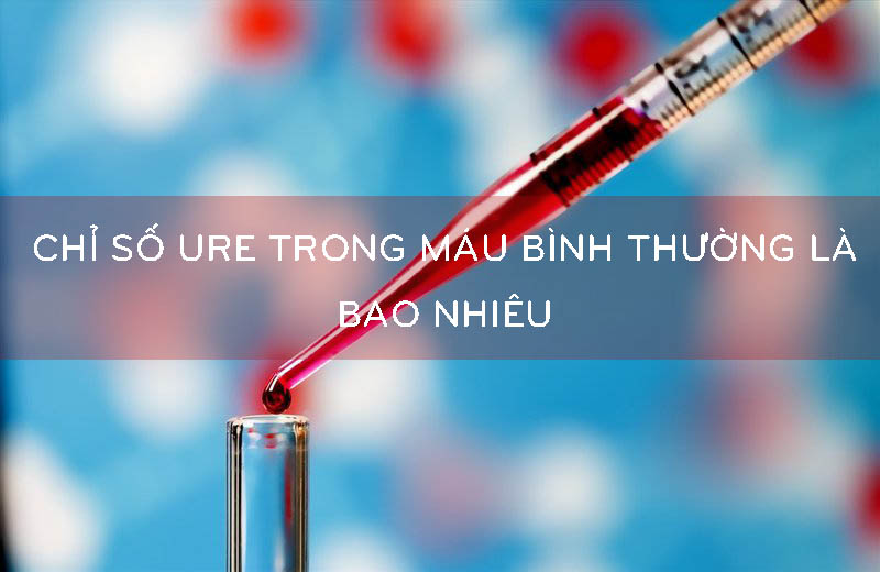 Tìm gọi về định lượng ure máu Tìm hiểu về định lượng ure máu
