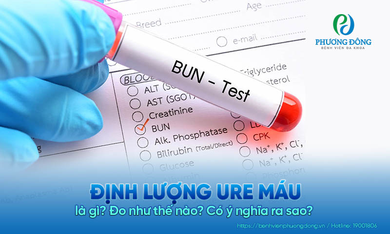 Định lượng ure huyết là gì Định lượng ure máu là gì