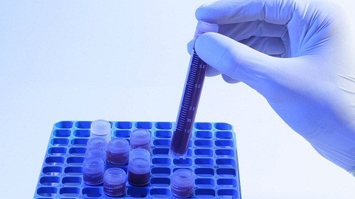 Giải đáp thắc mắc xét nghiệm estradiol để làm gì Giải đáp thắc mắc xét nghiệm estradiol để làm gì