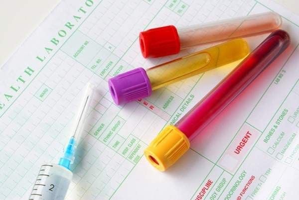 Định lượng estradiol là gì Định lượng estradiol là gì