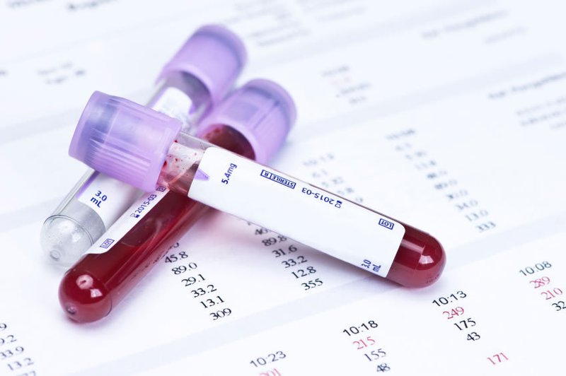Ý nghĩa của chỉ số hemoglobin Ý nghĩa của chỉ số hemoglobin