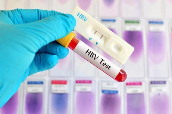 Xét nghiệm hbsag là gì Xét nghiệm hbsag là gì