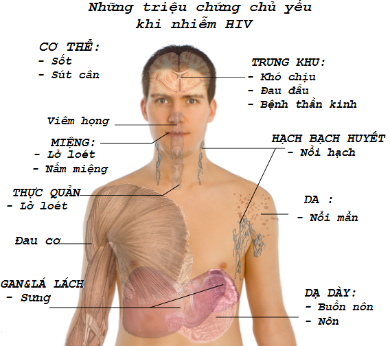 Triệu chứng hiv ở quy trình đầu Triệu triệu chứng hiv ở quy trình tiến độ đầu