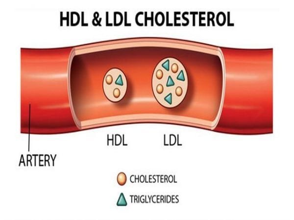 Chỉ số ldl cholesterol trong huyết là gì Chỉ số ldl cholesterol trong tiết là gì