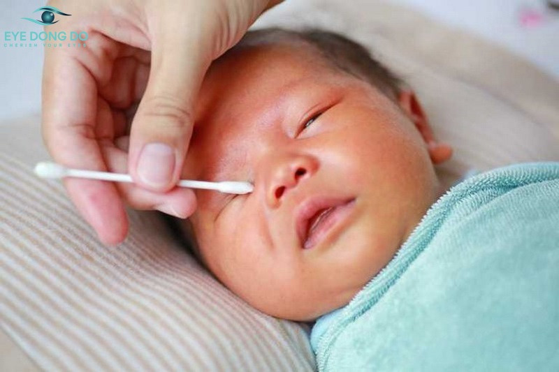 Vệ sinh mắt mang đến trẻ sơ sinh và một trong những điều đề xuất lưu ý Vệ sinh mắt đến trẻ sơ sinh và một vài điều buộc phải lưu ý