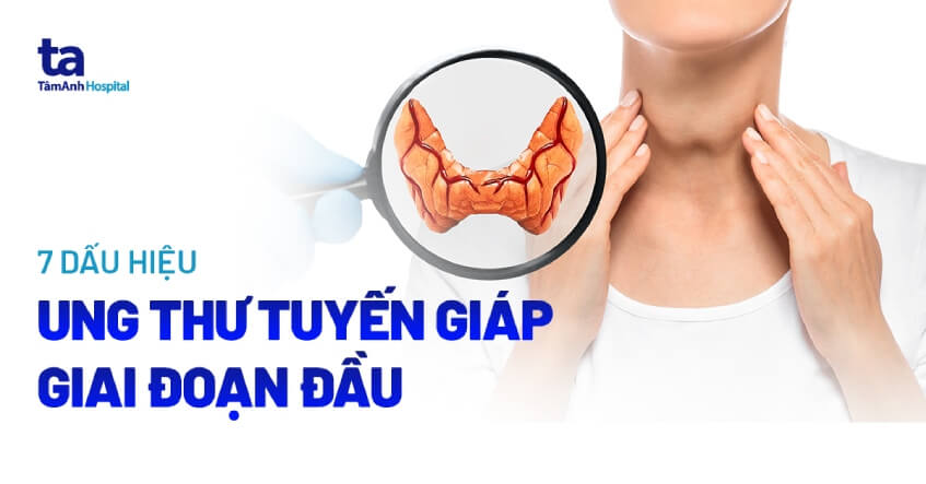 Dấu hiệu ung thư tuyến đường giáp giai đoạn đầu dễ nhấn biết Dấu hiệu ung thư con đường giáp quá trình đầu dễ nhận biết