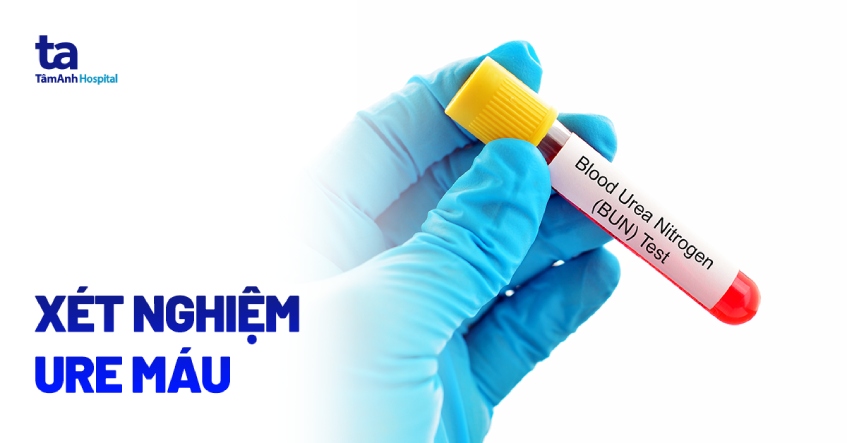 Xét nghiệm ure máu để làm gì Xét nghiệm ure máu để triển khai gì