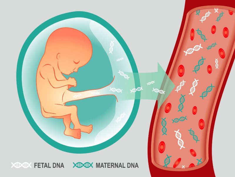 Làm xét nghiệm nipt là gì cùng những vấn đề cần biết Làm xét nghiệm nipt là gì cùng những điều cần biết