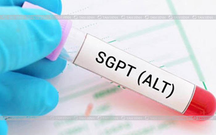 Xét nghiệm alt, Ý nghĩa, quy trình và cách hiểu kết quả