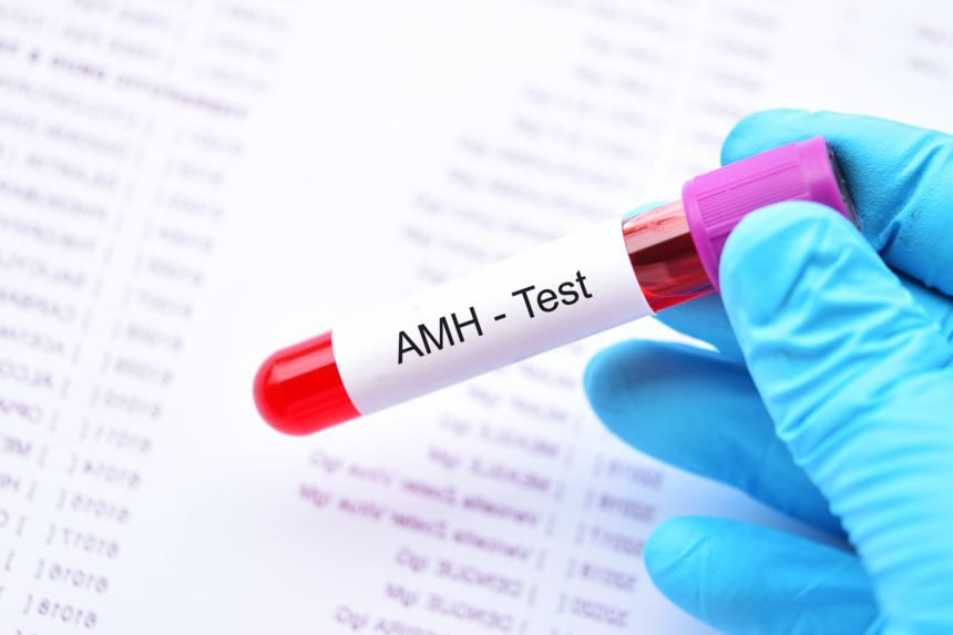 Chỉ số amh trong xét nghiệm thể hiện điều gì về sức khỏe sinh sản sinh hoạt phụ nữ Chỉ số amh trong xét nghiệm tạo nên điều gì về sức khỏe sinh sản nghỉ ngơi phụ nữ