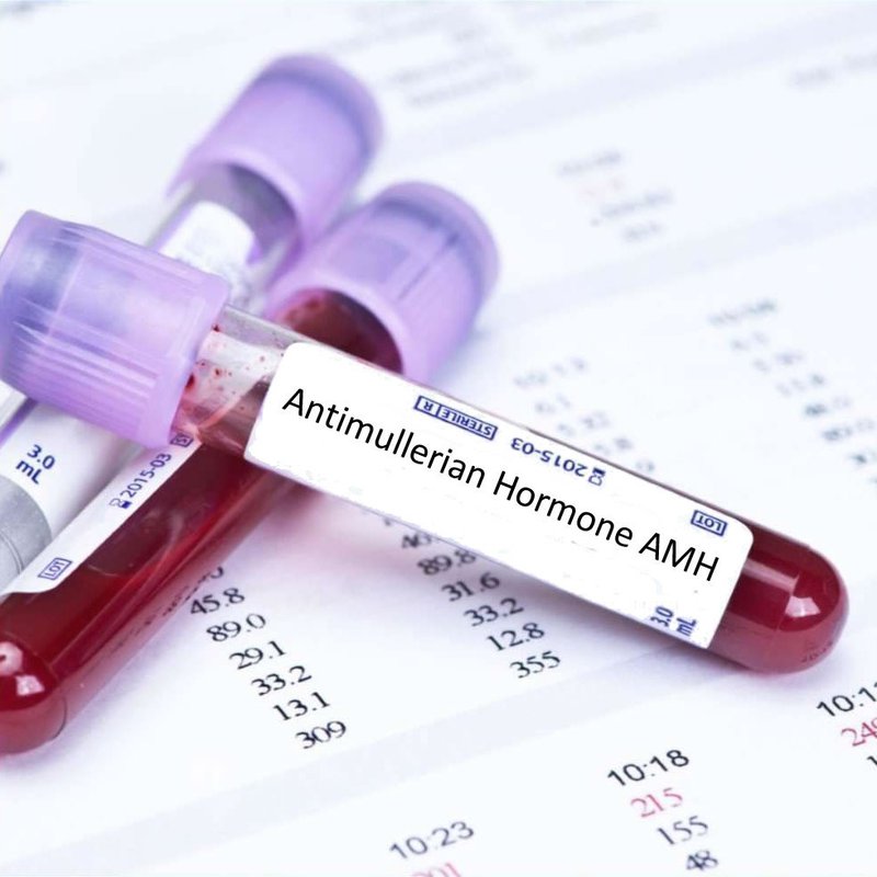 Xét nghiệm amh Xét nghiệm amh