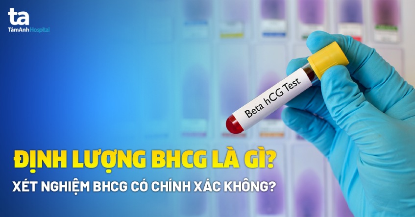 Xét nghiệm bhcg là gì Xét nghiệm bhcg là gì