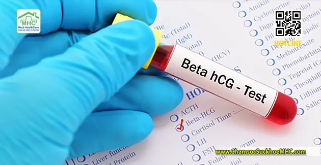 Xét nghiệm beta hcg tận nơi tại tphcm Xét nghiệm beta hcg tại nhà tại tphcm