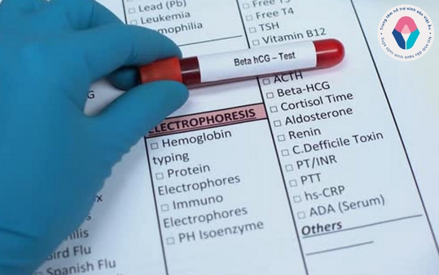 Xét nghiệm beta hcg là gì Xét nghiệm beta hcg là gì