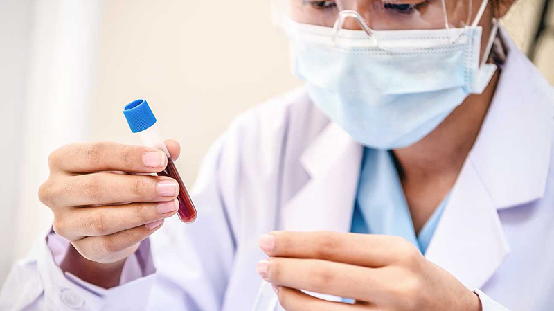 Xét nghiệm bilirubin là gì và ý nghĩa của nó trong y học Xét nghiệm bilirubin là gì và ý nghĩa của nó trong y học