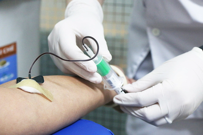 Xét nghiệm bilirubin là gì và ý nghĩa của bilirubin trong y học Xét nghiệm bilirubin là gì và ý nghĩa của bilirubin trong y học