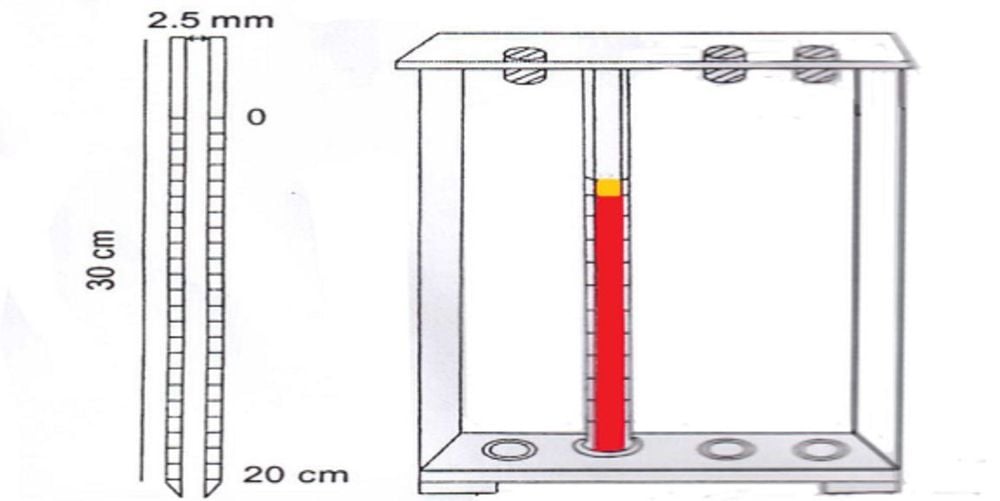 Xét nghiệm vận tốc máu lắng để gia công gì Xét nghiệm vận tốc máu lắng để triển khai gì