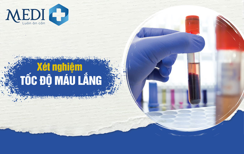 Xét nghiệm vận tốc máu lắng esr có chân thành và ý nghĩa gì Xét nghiệm tốc độ máu lắng esr có ý nghĩa gì
