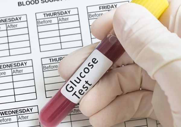 Xét nghiệm glucose là gì Xét nghiệm glucose là gì