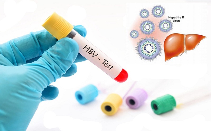 Kết quả xét nghiệm hbsag như nào minh chứng bị viêm gan b Kết trái xét nghiệm hbsag như nào chứng minh bị viêm gan b
