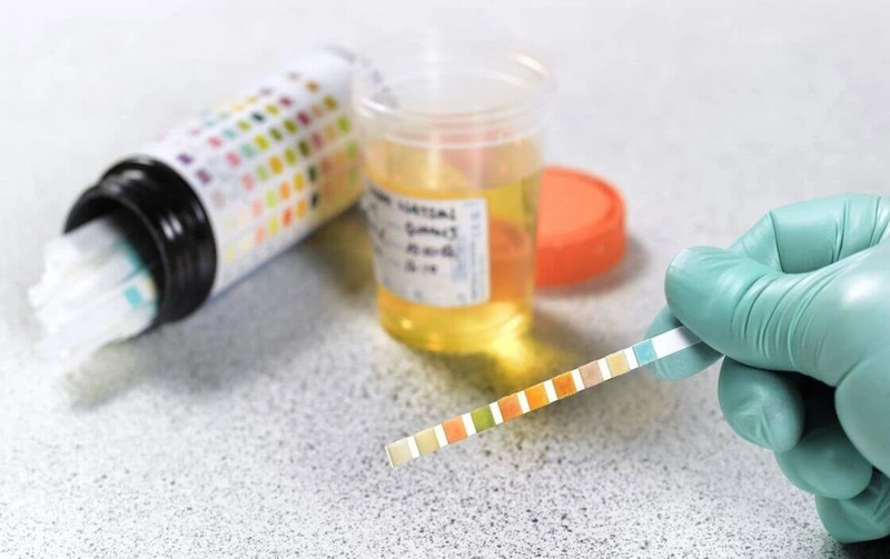 Ketone là gì Ketone là gì