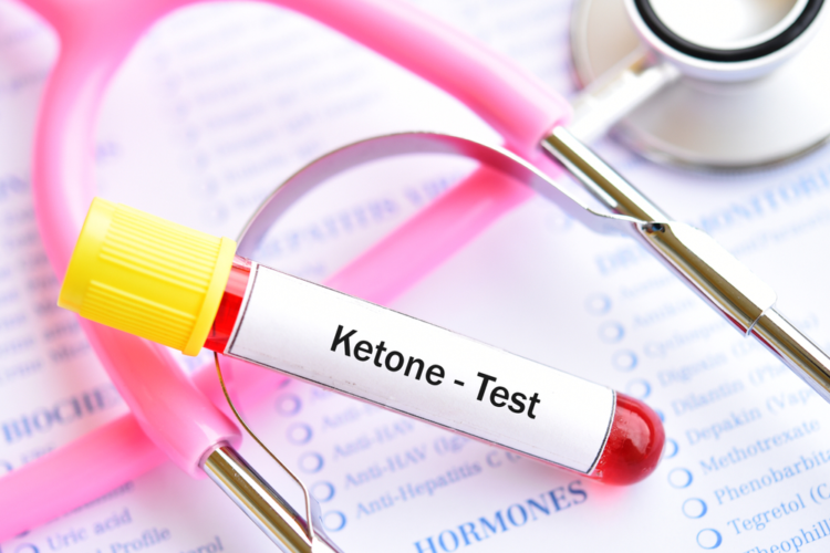 Hiểu biết về ketone để ngừa căn bệnh tiểu đường Hiểu biết về ketone nhằm ngừa bệnh tiểu đường