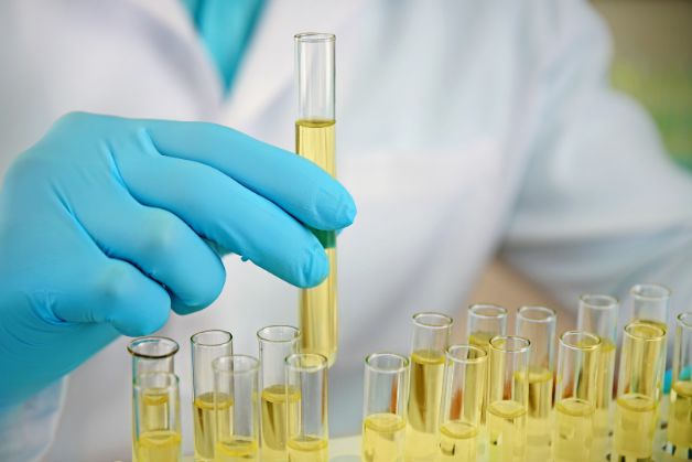 Xét nghiệm nước tiểu thông số là gì Xét nghiệm thủy dịch thông số kỹ thuật là gì