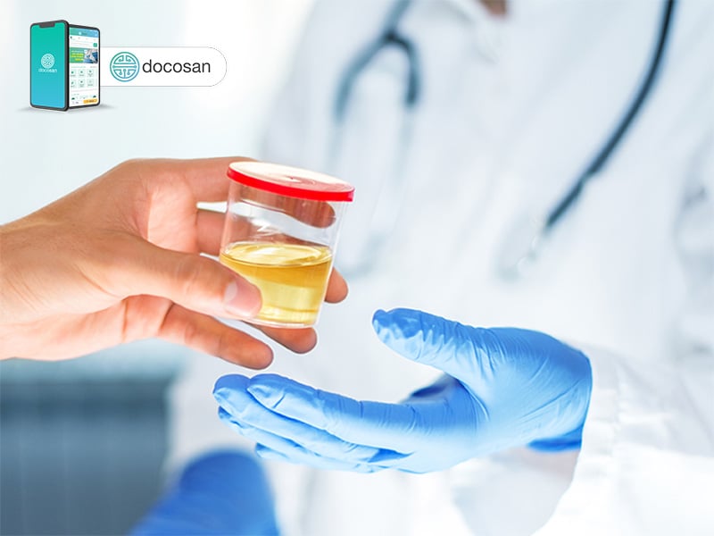 Các chỉ số và chân thành và ý nghĩa của xét nghiệm nước tiểu Các chỉ số và chân thành và ý nghĩa của xét nghiệm nước tiểu