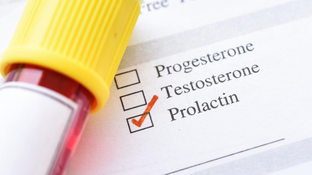 Xét nghiệm prolactin là gì Xét nghiệm prolactin là gì