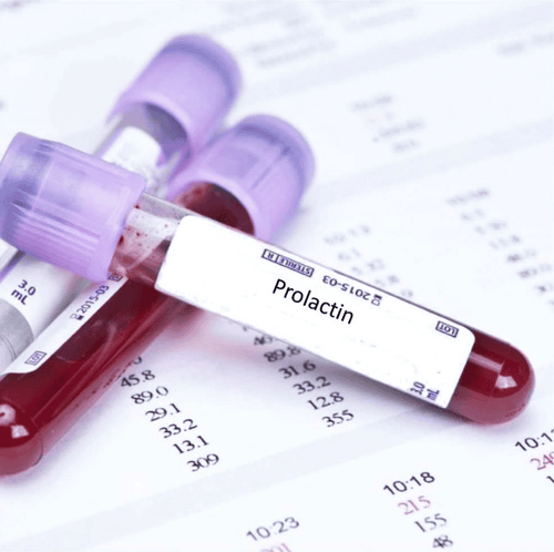 Khi nào buộc phải xét nghiệm hooc môn prolactin Khi nào yêu cầu xét nghiệm hooc môn prolactin
