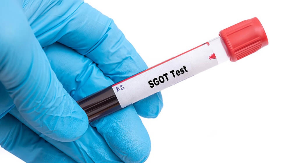 Sgot trong xét nghiệm tiết là gì Sgot vào xét nghiệm tiết là gì