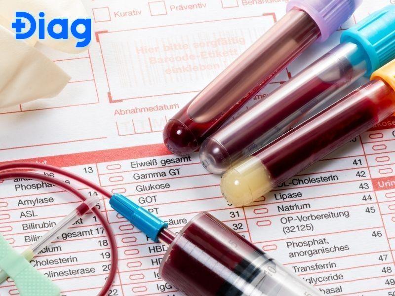 Xét nghiệm sinh hóa tiết là gì Xét nghiệm sinh hóa ngày tiết là gì