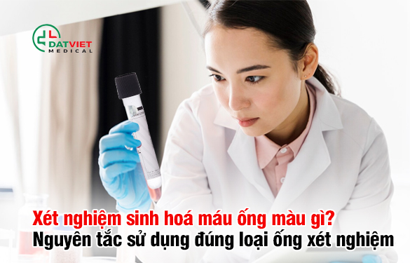 Xét nghiệm sinh hoá máu ống màu gì Xét nghiệm sinh hoá tiết ống màu sắc gì