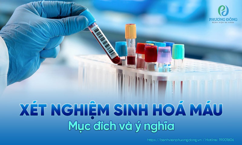 Xét nghiệm sinh hóa huyết là gì Xét nghiệm sinh hóa tiết là gì