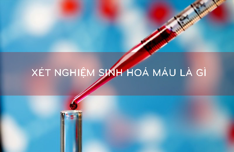 Xét nghiệm sinh hoá huyết là gì Xét nghiệm sinh hoá ngày tiết là gì
