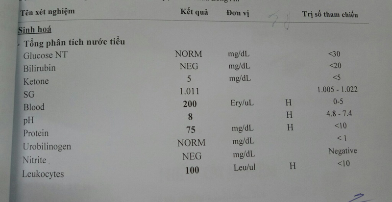 Ý nghĩa norm là gì trong kết quả xét nghiệm nước tiểu Ý nghĩa norm là gì trong tác dụng xét nghiệm nước tiểu
